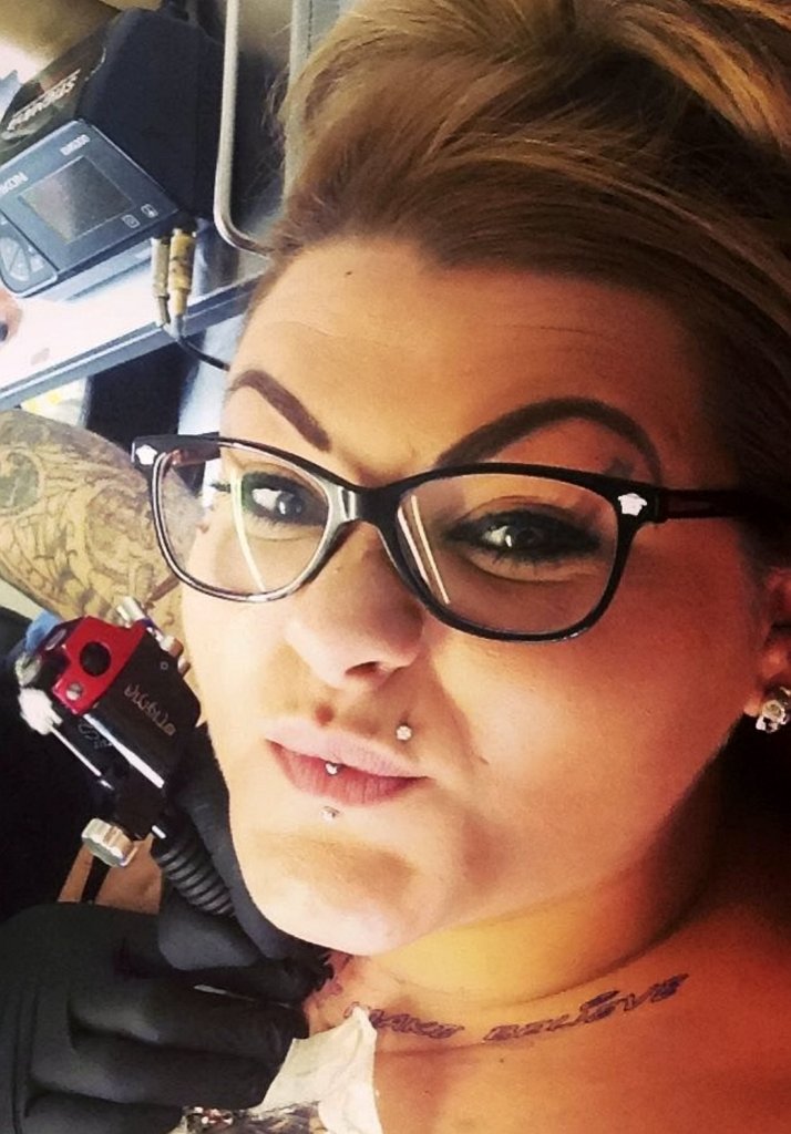 Despite her nightmare ordeal Dennie is still determined to go under the knife again to have her left breast enlarged to match her right one