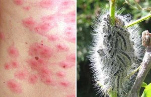 Caterpillars which are toxic to humans and pets are invading UK
