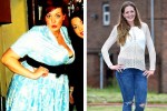 Weight loss