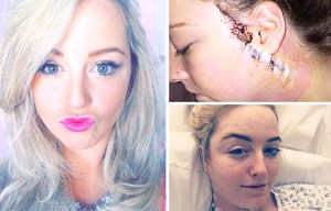 Bride-to-be who shared pics of skin cancer scars online cruelly trolled by Facebook users who said she was 'making it up'