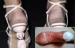 foot heel composite