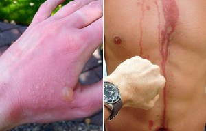 Drinking alcohol in the sun could do serious damage to your skin... here’s why