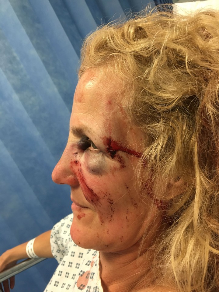 The blood-soaked gran looked like something 'out of a horror show', her family said