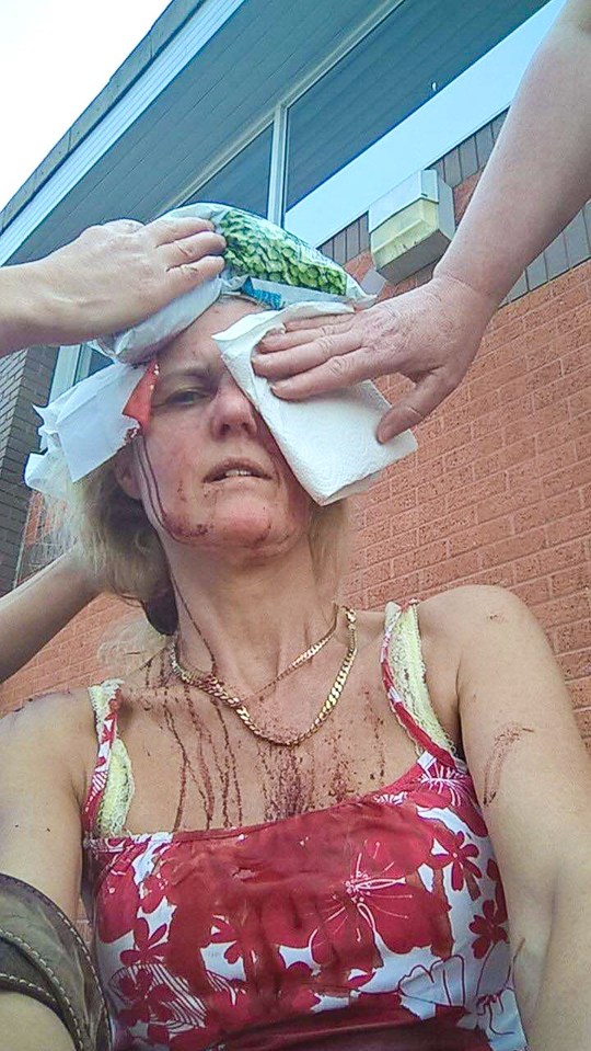 The blood-soaked gran was rushed to hospital after the horrific incident