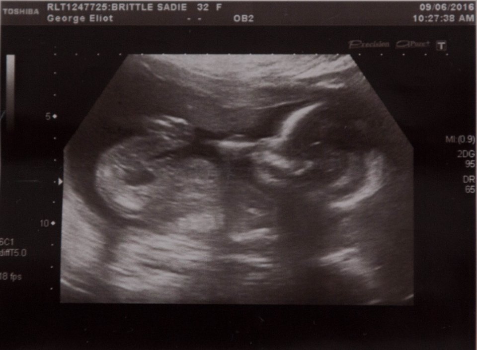 The shocked couple are now expecting their newborn in November
