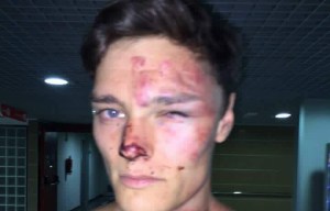 Magaluf hotel where 3 Brits were battered by security is blasted on TripAdvisor