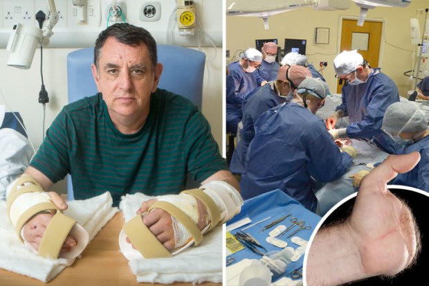 composite double hand transplant