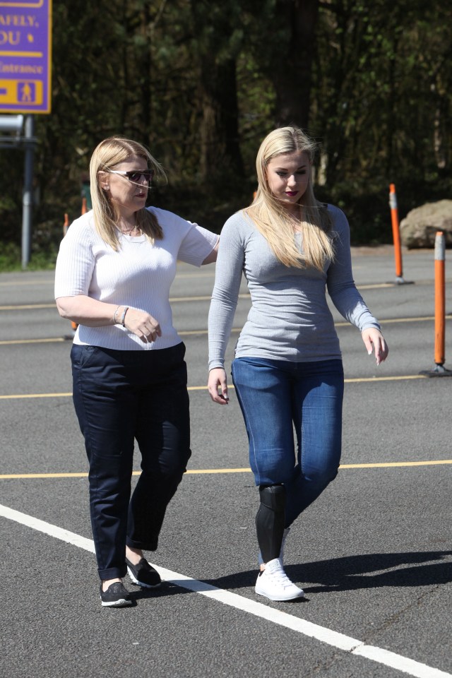 In April she got a prosthetic leg for the first time which she says has given her more confidence