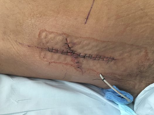 MAn stabbed in back