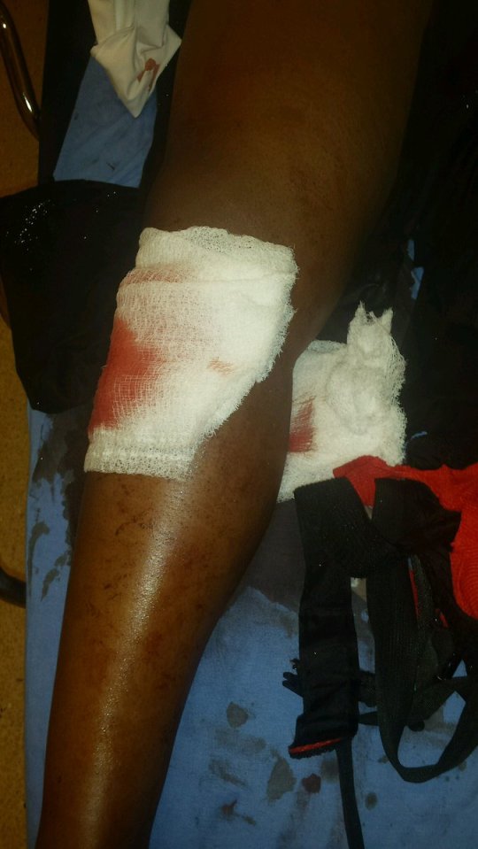 Shetamia Taylor underwent surgery for her injuries but is expected to make a full recovery