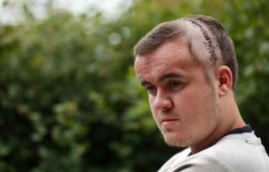 Teen suffers shocking head injuries in near fatal one punch-assault
