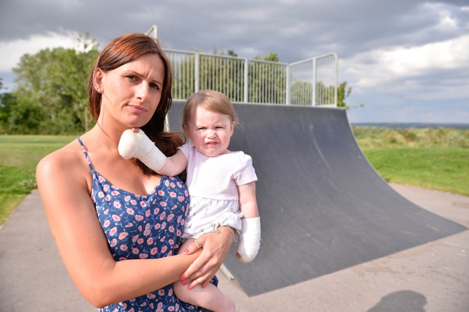 The youngster's hands went bright red and blistered as soon as she touched the metal
