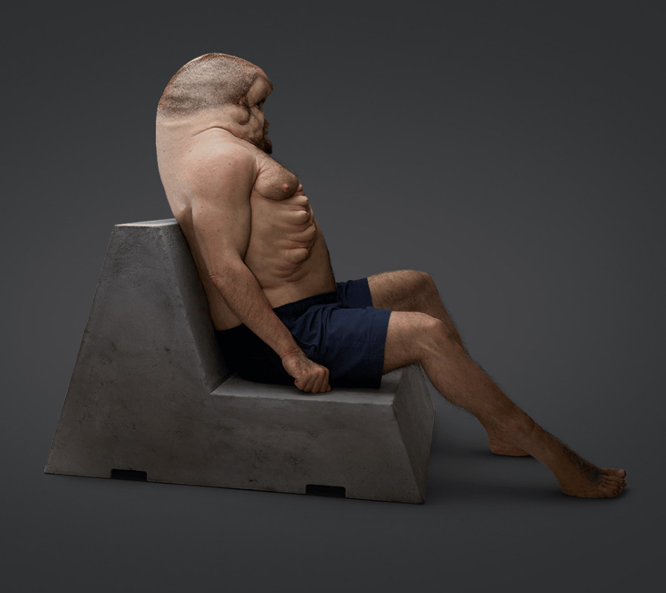 He has no neck or spinal cord and his ribs 