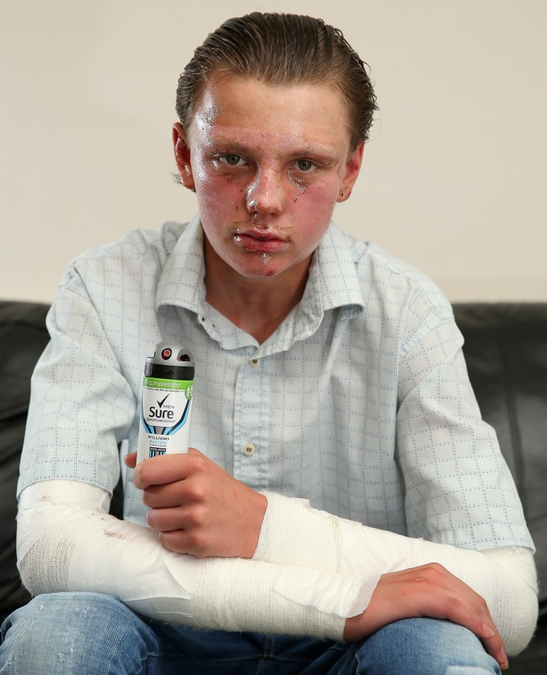 The teenager was playing with a Sure can, like that pictured, when it exploded