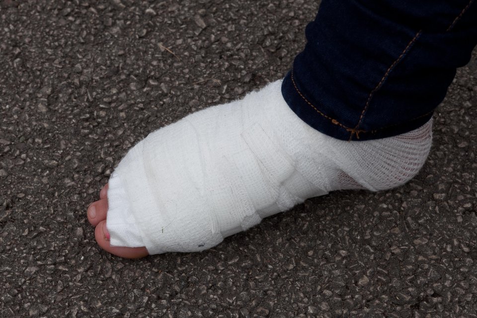 Leah was left with painful injuries which required a trip to hospital