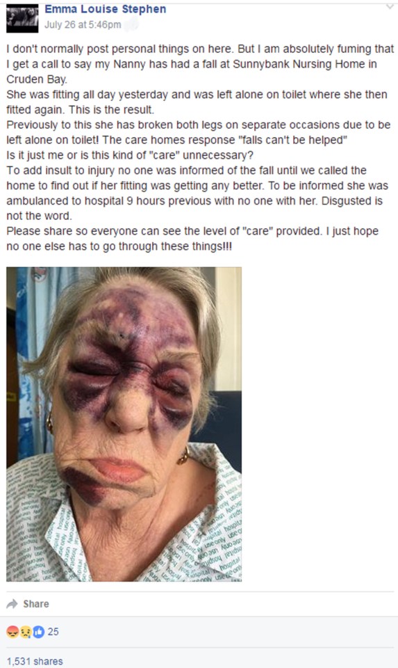 The image of Jill Symmonds shows a mass of black bruises stretching from her jaw to her eyes and forehead after the incident in Aberdeenshire