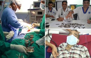 Doctors left baffled after removing 40 knives from stomach of policeman who complained of tummy ache