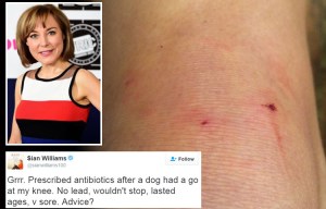 News presenter Sian Williams 'sore, swollen and bruised' after being attacked by dog