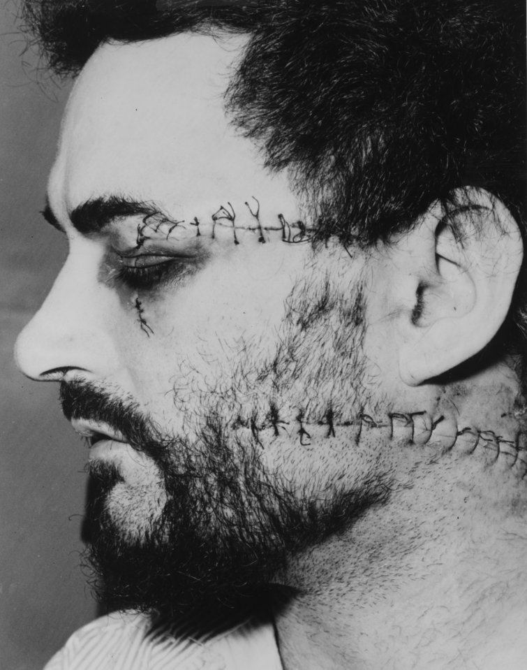 The ripper has been previously attacked including an assault by Costello with a coffee jar