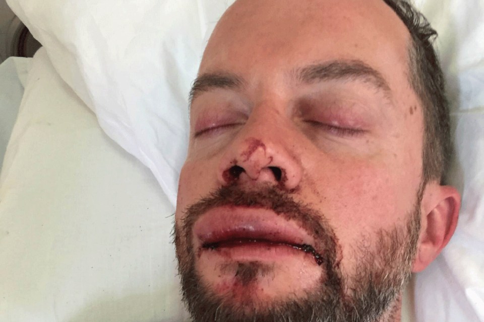 Vestel was unconscious until he arrived at hospital on the Greek island