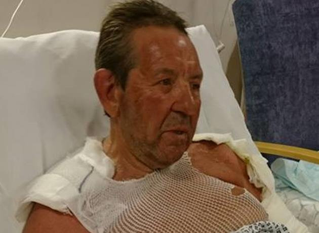 Tory MP Gordon Henderson was saved by his wife after being engulfed in flames from a bonfire