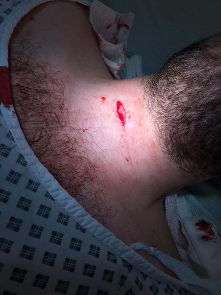Owen says he thought he was going to die as the chaotic scenes unfolded