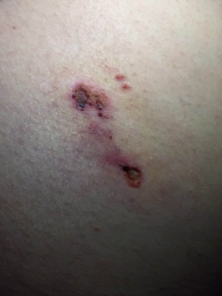 DAD BITTEN ON TESTICLES WHILE SAVING CHILDREN FROM DOG ATTACK