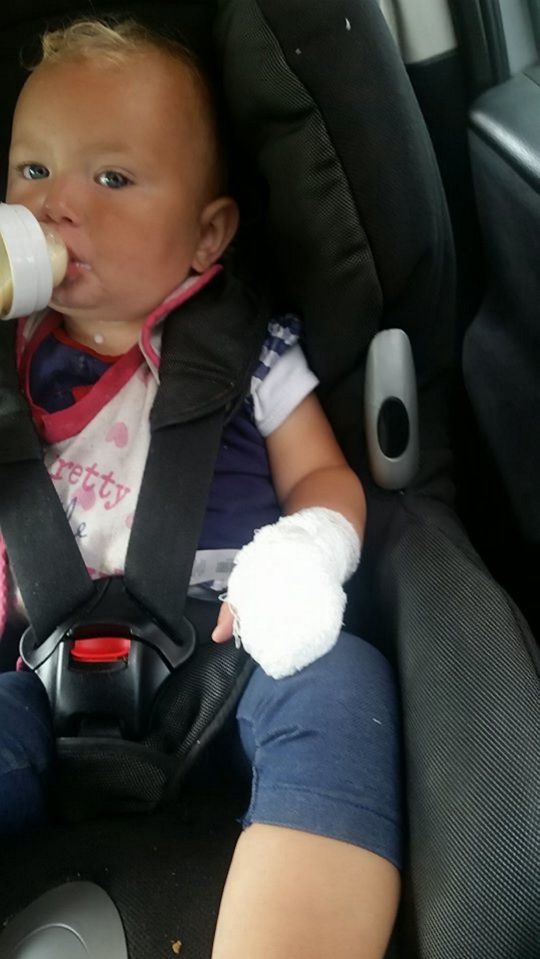 The little girl is now suffering from nightmares after her dad was forced to wrench a dog's jaws from her hand