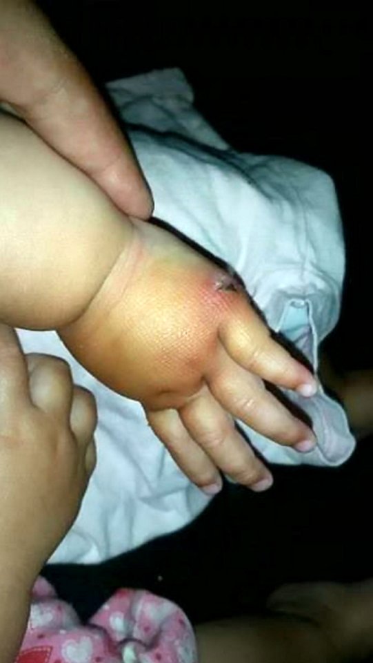 The greyhound locked its jaws around the tot's hand on a day out