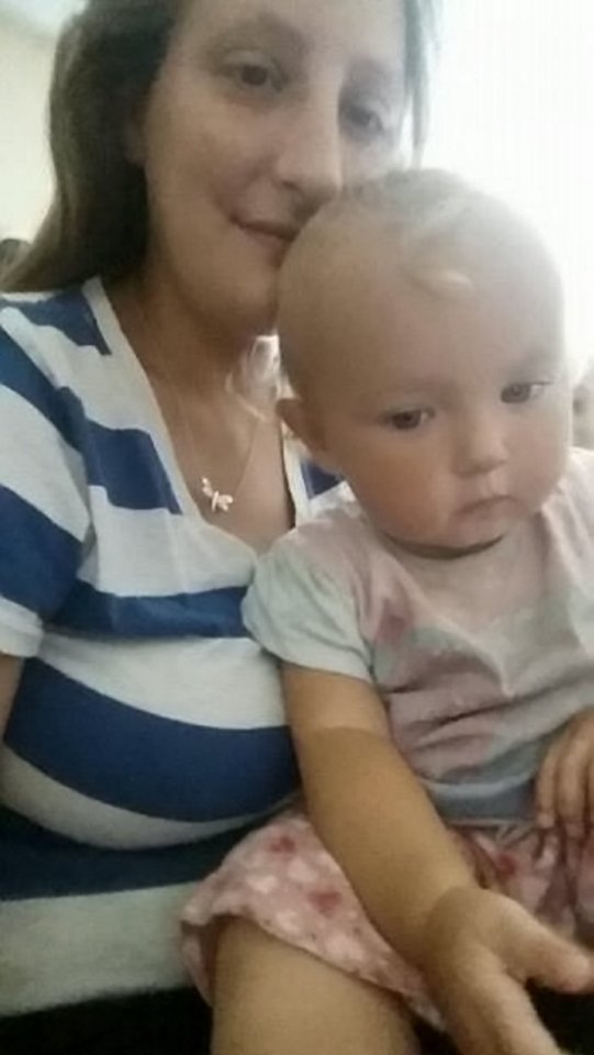 Vicky Hawkes pictured with daughter Abbiegale Osman-Hawkes who could be scarred for life after nasty dog attack