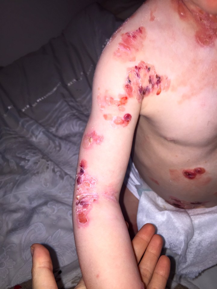 Mum Danni has been verbally attacked by vicious strangers who believe Isla is sunburnt