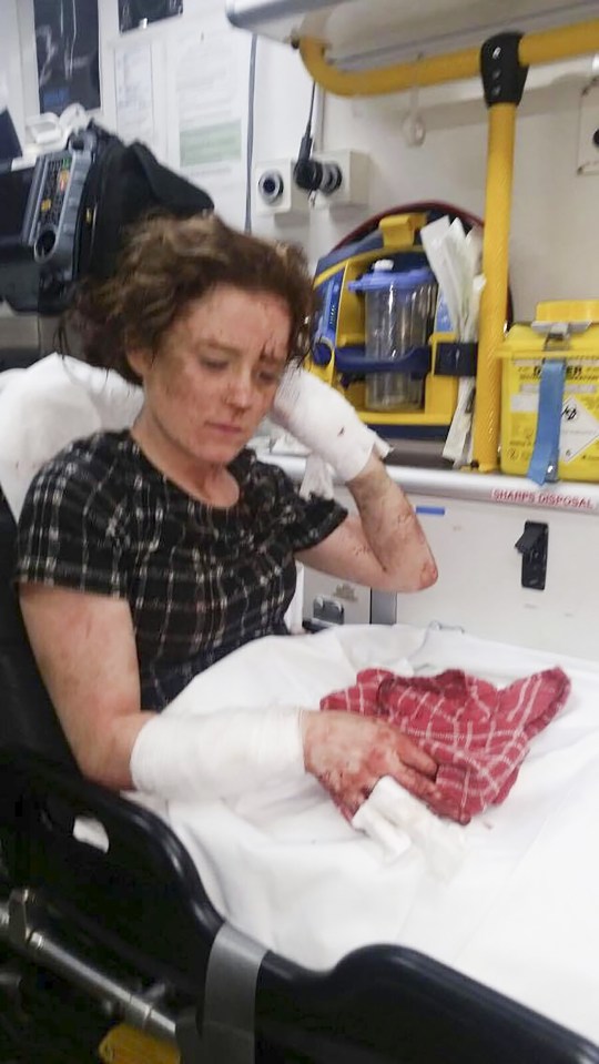 Chloe Parkes attacked by boyfriend