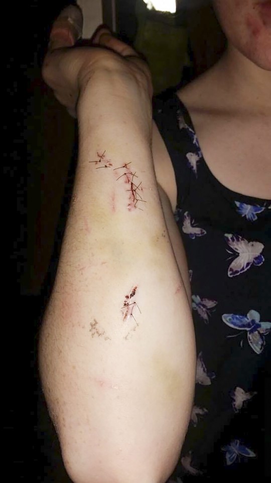 Chloe Parkes attacked by boyfriend
