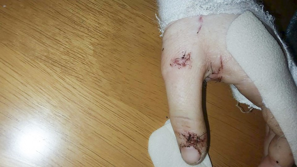 Chloe Parkes attacked by boyfriend