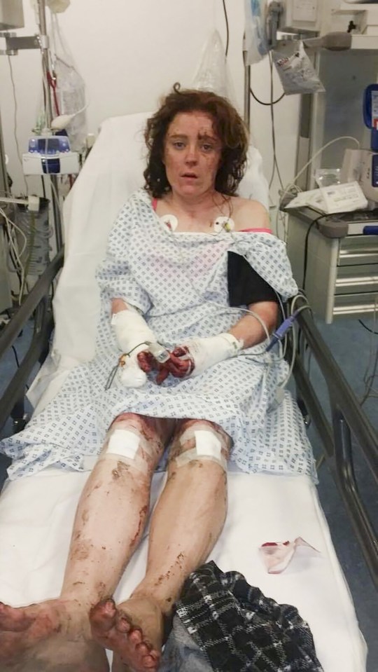 Chloe Parkes attacked by boyfriend