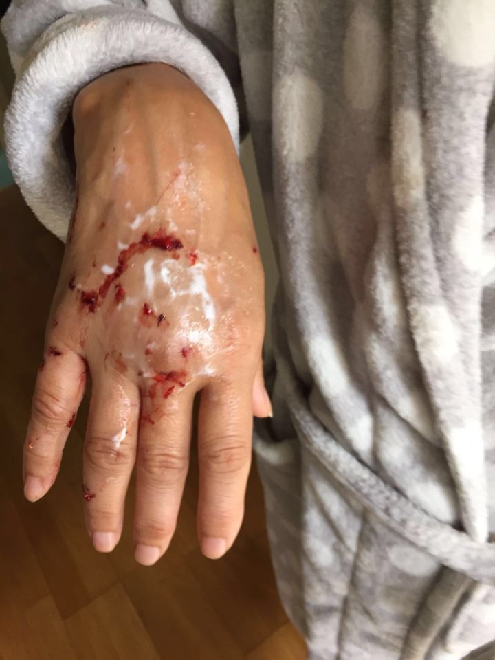 Fatima El-Tawi cat attack