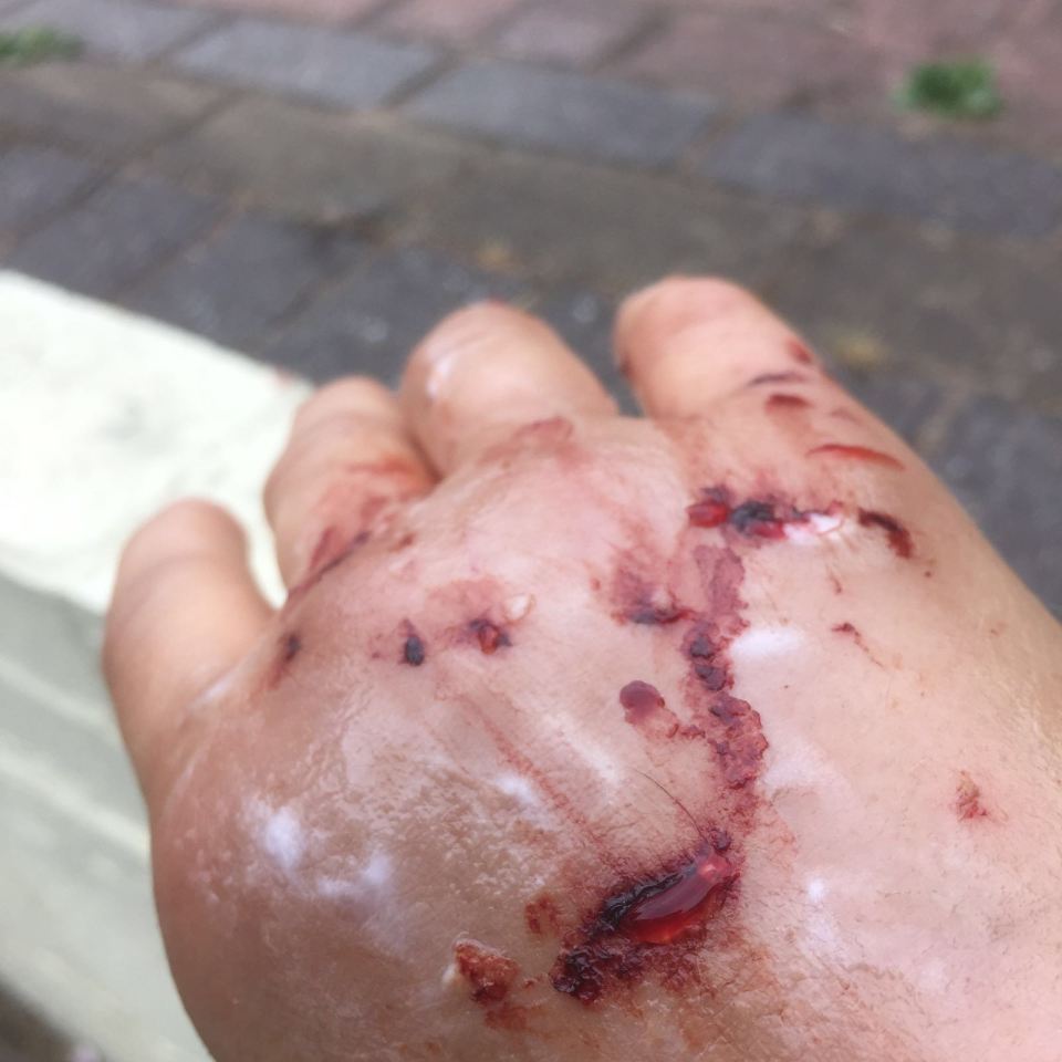 Fatima El-Tawi cat attack