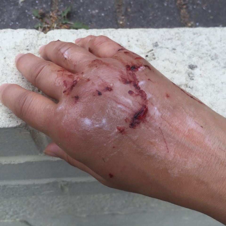 Fatima El-Tawi cat attack