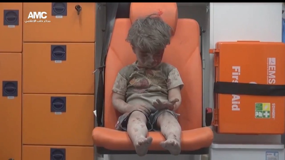 The bloodied Syrian boy stares at his hand after the airstrike, which claimed a number of lives