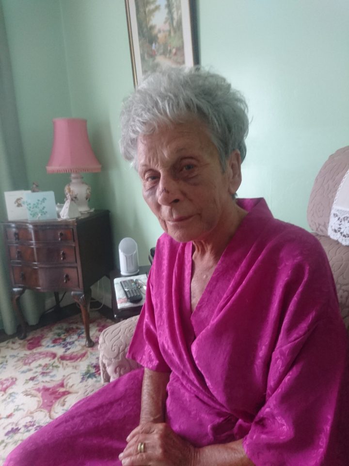 Joan Veysey was left with a broken nose and two black eyes after falling over in the street