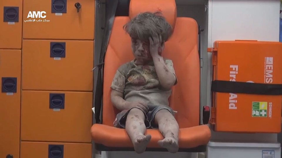 Un-moving until he reached up to mop the blood from his face the young boy reminded the world of the plight of syrians