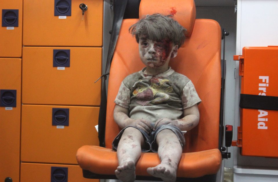Staring blankly ahead, soundless in the back of an ambulance, Omran Daqneesh's photo stunned the globe