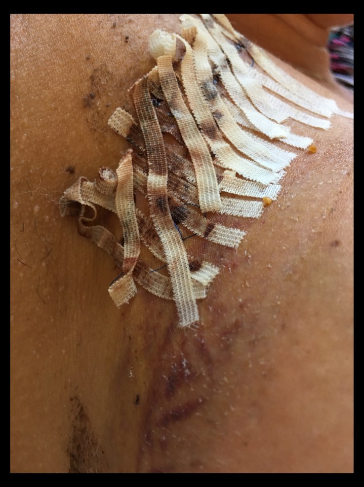 40 stitches . . . Karen needed urgent medical attention