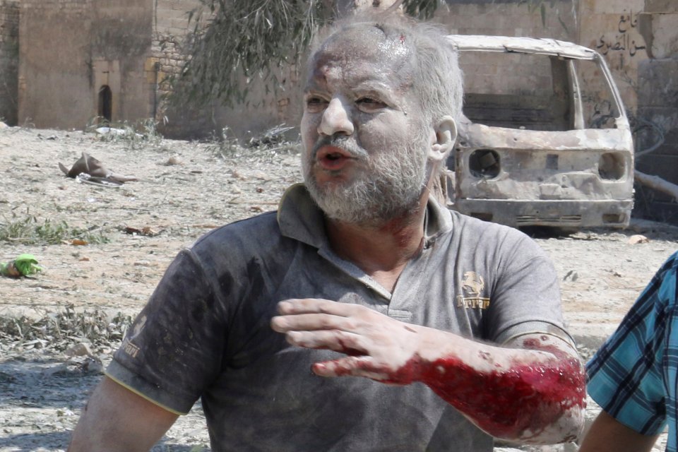 An injured man is covered in concrete dust after huge explosion left at least 15 people dead