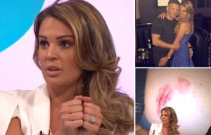 Danielle Lloyd recalls terror of watching fiancé attacked by vicious pitbull