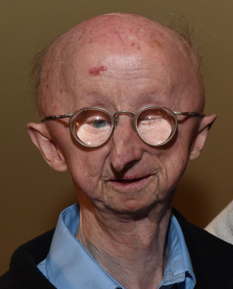 Alan Barnes mugging