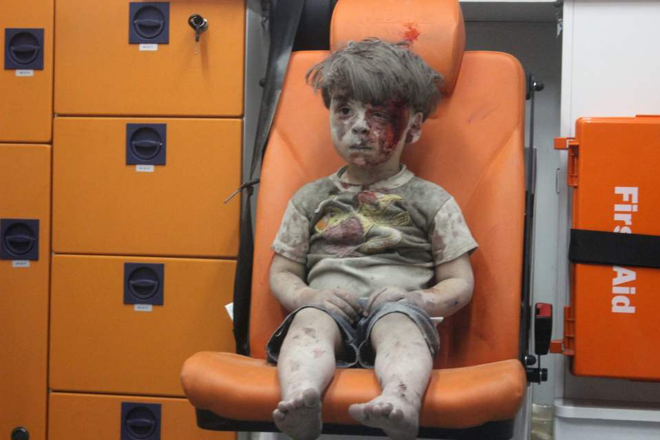 Omran, a four-year-old Syrian boy covere