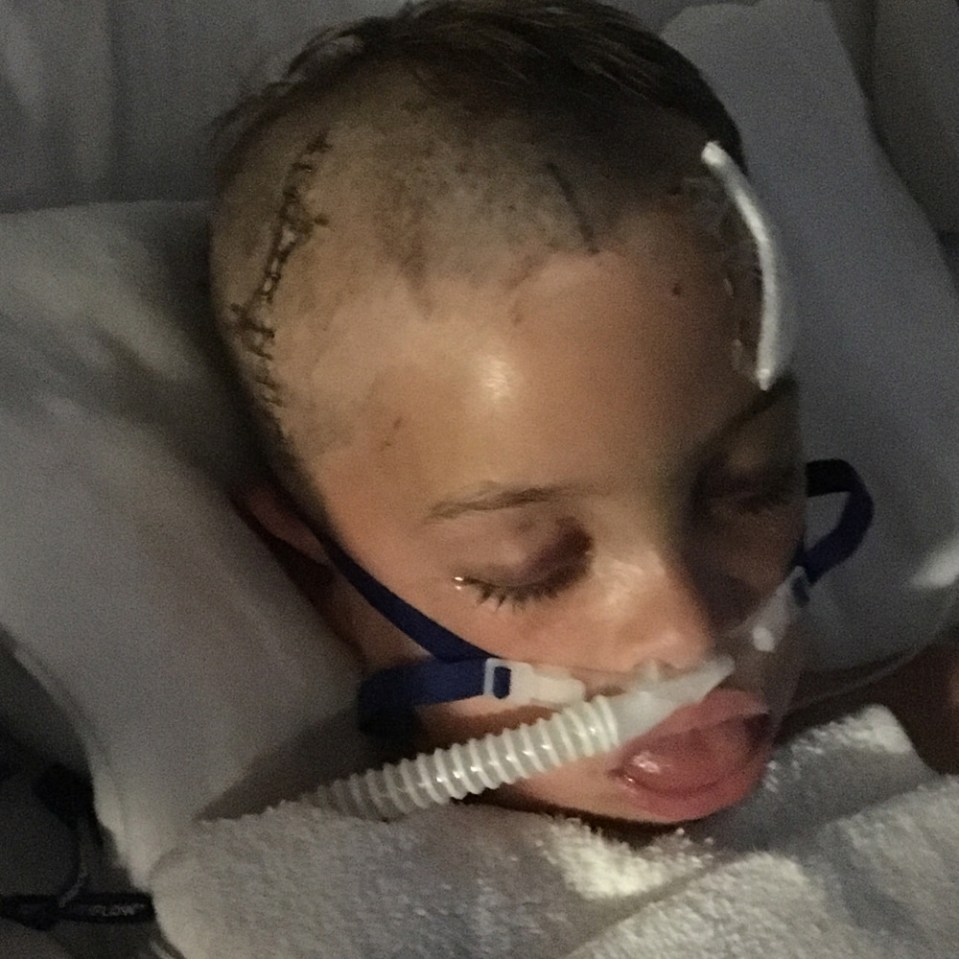 Scott in hospital after the explosion (Collect - PA Real Life)