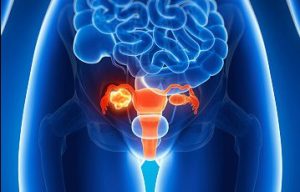 Dramatic decline in ovarian cancer deaths 'due to more women taking the contraceptive Pill'