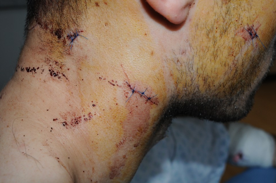 CCTV released of man stabbed in neck on way to work